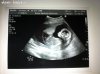 16.5 weken baby2.jpg