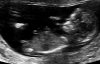 echo-baby.jpg