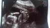 20wk.jpg