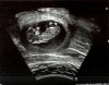 Echo 11w6d(3).jpg