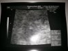 echo 1 28-12-2012.jpg