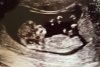 baby.jpg