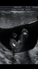 DF19AAB9-D7AE-4C2E-A5F7-5B03765A5AA2.png