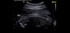 Screenshot_20180711-132107_WhatsApp.jpg