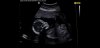 Screenshot_20180711-132100_WhatsApp.jpg