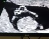 Screenshot_20180716-224456_Gallery.jpg
