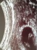 20180804_115236.jpg