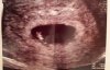 20180807_165818.jpg