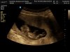J180382_1564422_Echo.Jpg