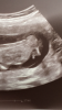 C021C88A-ABFC-4F80-A93A-FB6962123A83.png