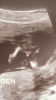 9D51C125-059D-4AE8-9781-4986AA470788.png