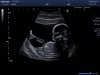 patient135401.jpg.jpg
