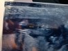 20180901_095627.jpg