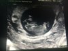 IMG-20170413-WA0000.jpg