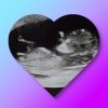 photocollage_201882823453850.jpg