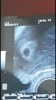 Screenshot_20180912-143327.png