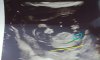 IMG_20180915_061258.jpg