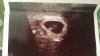 IMG-20180917-WA0006.jpeg