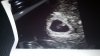 IMG-20180917-WA0010.jpeg