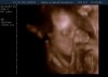 12-12-28-120222_BABY  KEMNA_20121228_124105_0017.BMP.jpg