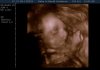 12-12-28-120222_BABY  KEMNA_20121228_124105_0001.BMP.jpg