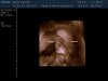 13-01-07-181710_BABY KEMNA_20130107_183305_0003.jpg