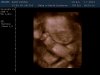 13-01-07-181710_BABY KEMNA_20130107_183305_0010.jpg