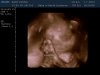 13-01-07-181710_BABY KEMNA_20130107_183305_0018.jpg