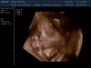 13-01-07-181710_BABY KEMNA_20130107_183305_0019.jpg