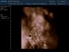 13-01-07-181710_BABY KEMNA_20130107_183305_0029.jpg