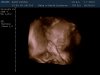 13-01-07-181710_BABY KEMNA_20130107_183305_0021.jpg