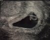 Baby vH.jpeg