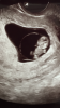 32555C2F-F9FA-470D-AB21-5D728FC89EBC.png