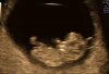 IMG-20181008-WA0000.jpg