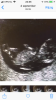 04A2E561-A20C-4317-999A-108D0CC97A74.png