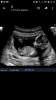 Screenshot_20181019-122538_WhatsApp.jpg