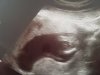 20181020_140843.jpg