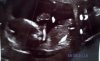 20181021_102603.jpg