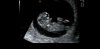 Screenshot_20181022-132036_Photos.jpg