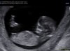 BABY 22-10-18_0004.jpg