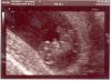 echo9wk6dg1.jpg