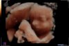 20181101191700_baby Heimans_201811010006_3D.jpg