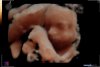 20181101191700_baby Heimans_201811010016.jpg