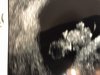 12685253-88DE-4039-9944-E6DF8E93501F.jpeg