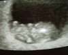 IMG_20181106_151941.jpg