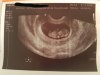 20181108_105110.jpg