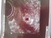 20181106_101951.jpg
