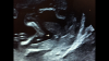 7AD1967B-91B3-42F8-8EDB-ED45E7A35742.png