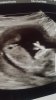 Screenshot_20181118-210920_Gallery.jpg