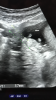 6CF84641-CBF2-4229-8A60-337681104986.png